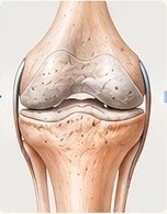 Knie mit abgenutztem Knorpel